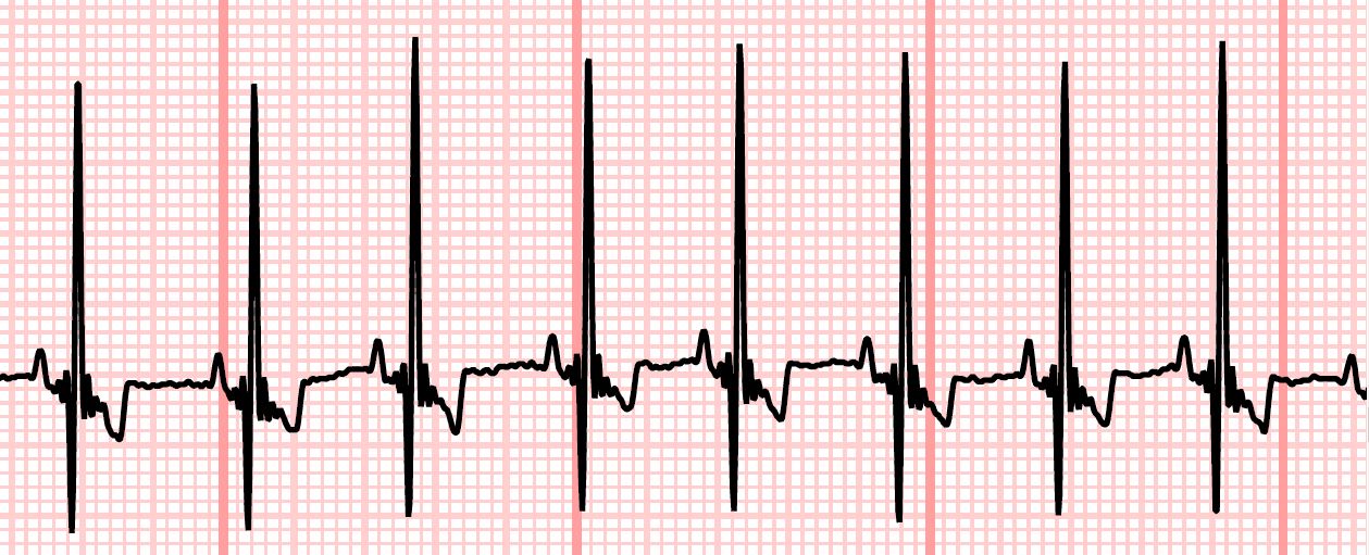Atrial Fibrillation Gulf Coast Veterinary Cardiology